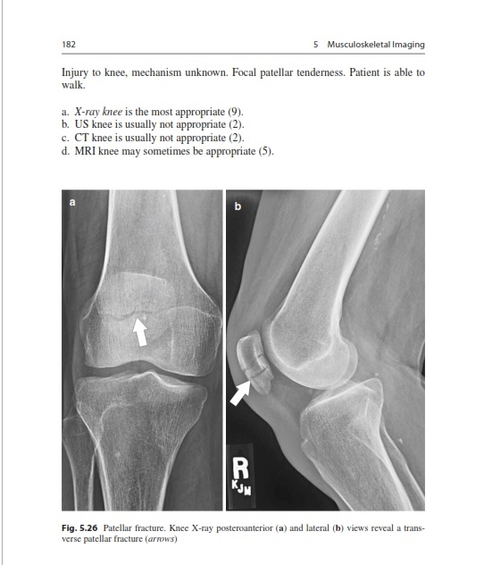 Choosing the Correct Radiologic Test Case-Based Teaching Fil