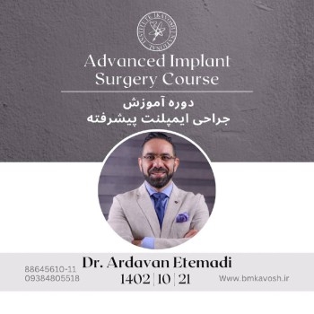 ایمپلنت پیشرفته