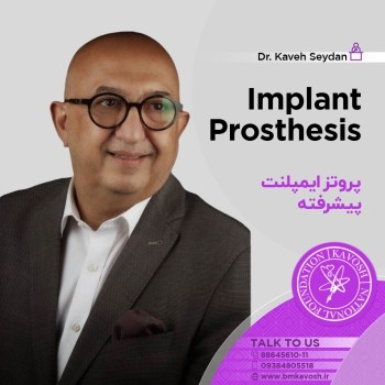 پروتز  پیشرفته ایمپلنت