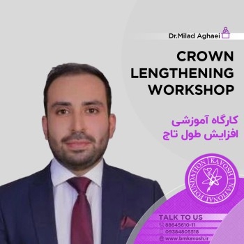 افزایش طول تاج