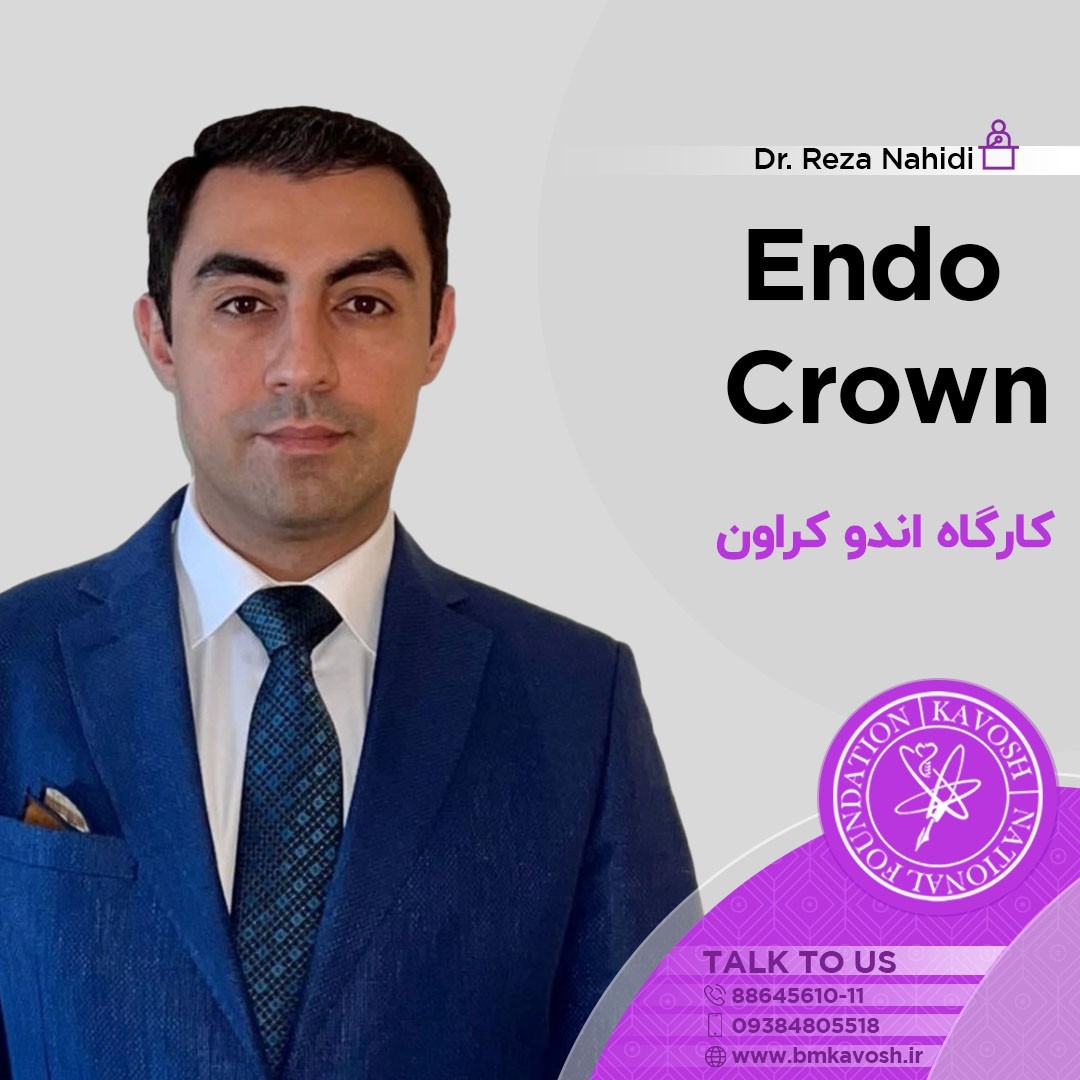 کارگاه اندوکراون
