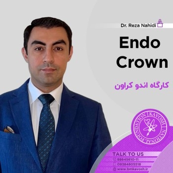 کارگاه اندوکراون
