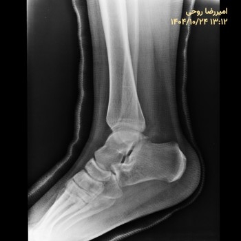 تست برنامه نویس