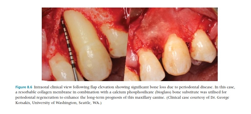Tissue Engineering and Regeneration in Dentistry Current Strategies